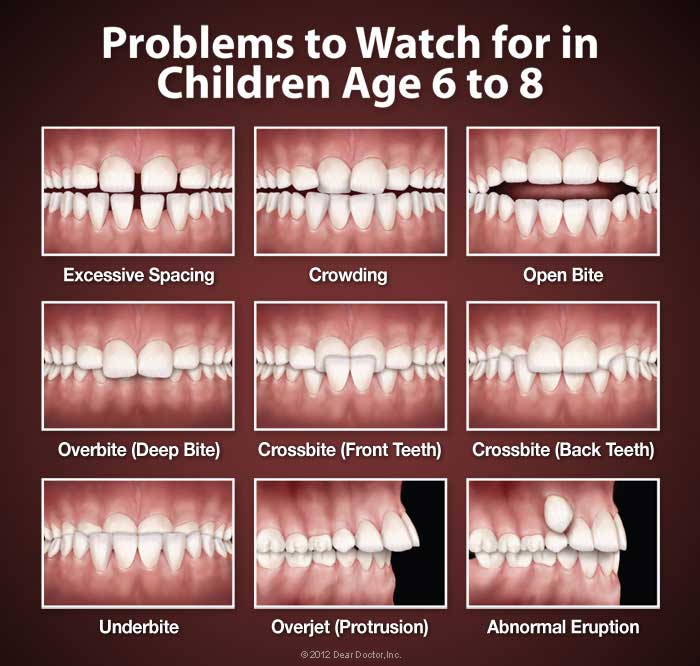 teeth problems