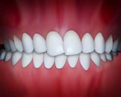 teeth example