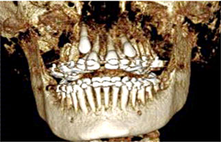 teeth scan